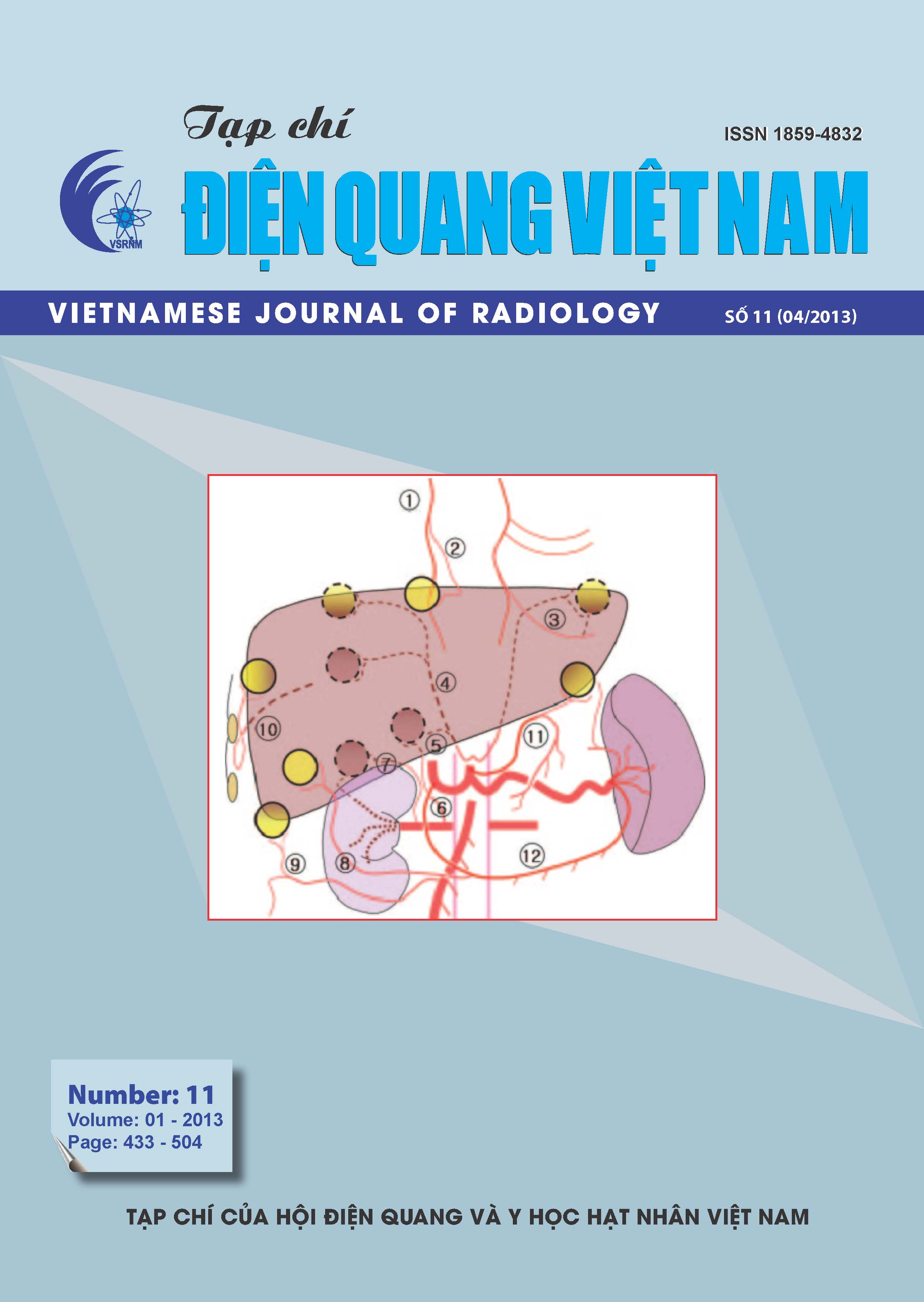 Động mạch gan chụp mạch số hóa: Công nghệ chụp mạch số hóa giúp các bác sĩ phát hiện và chẩn đoán bệnh gan một cách hiệu quả hơn. Với ứng dụng này, hình ảnh động mạch gan sẽ được số hóa và hiển thị trên màn hình máy tính. Điều này giúp bác sĩ đưa ra chẩn đoán chính xác và kế hoạch điều trị, mang lại hy vọng cho hàng ngàn bệnh nhân gan.